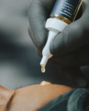 PDRN & EXOSOMES קיסו רגנרציה